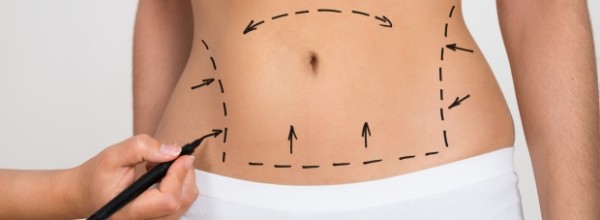 Liposuccion permanente