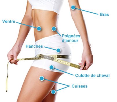 liposuccion en Suisse